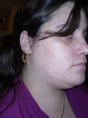 This is my bad side.